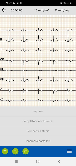 menu opciones ECG